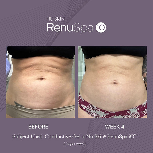 Nu Skin® RenuSpa/Wellspa iO™