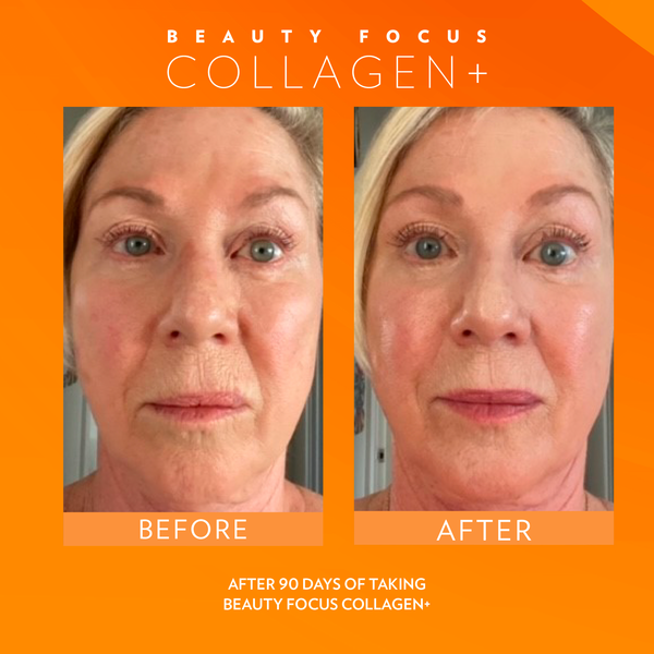 Beauty Focus® Collagen+